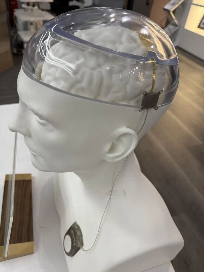 Brain Tiger Technology’s infinite fully implantable brain-computer interface model. Photo/Reporter Niu He